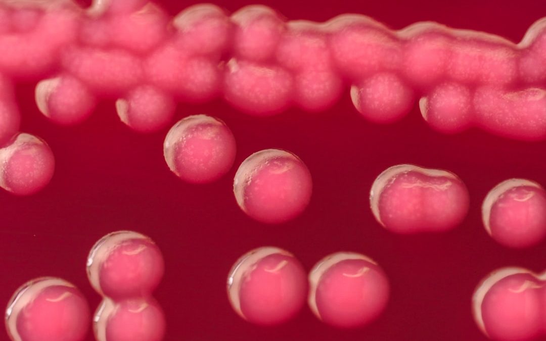 Photo Heterotrophic bacteria cultivation