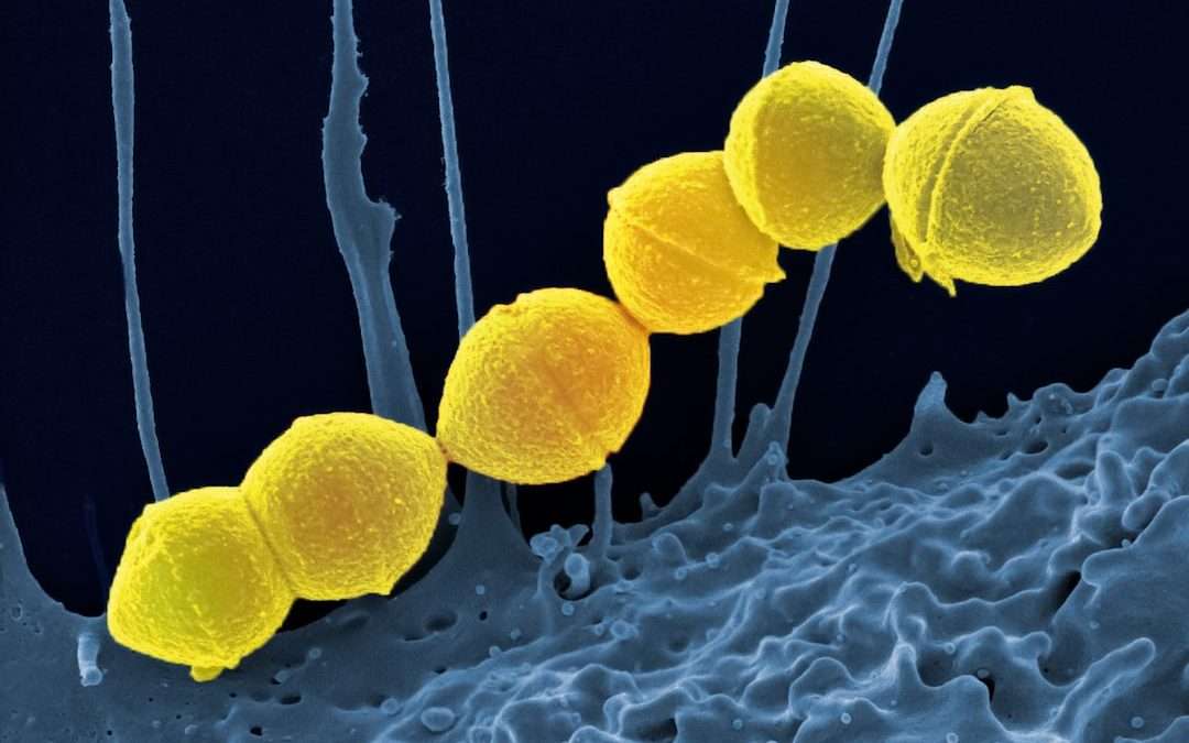 Legionella és háztartási vízrendszerek: mire figyelj otthon?