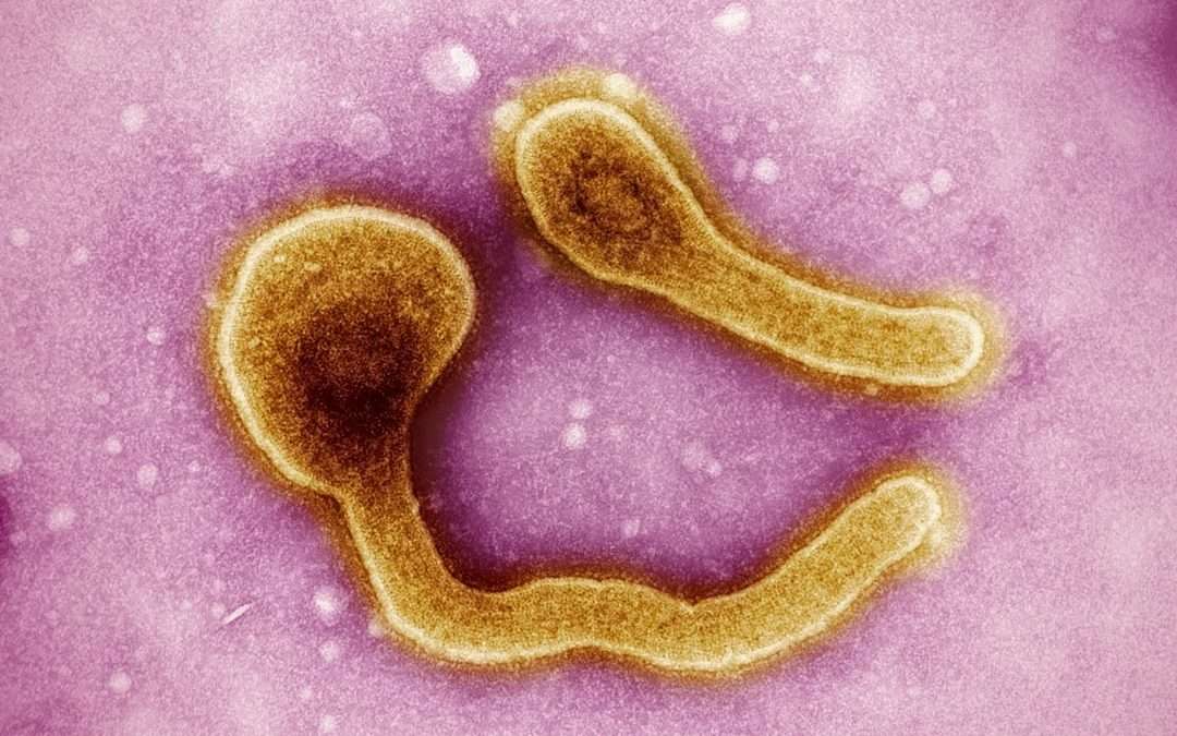 Photo Legionella