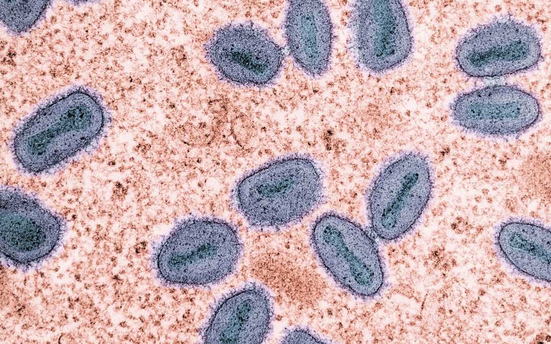 Photo Legionella